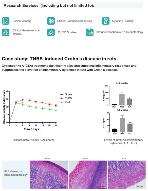 autoimmune disease models