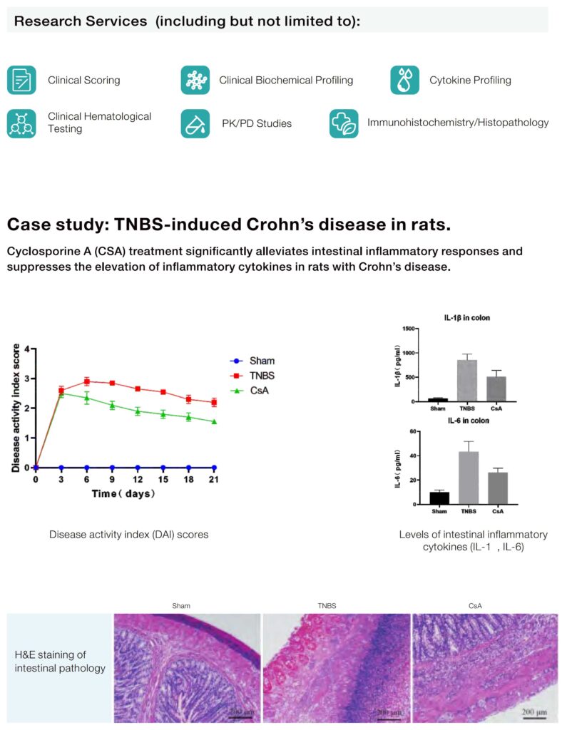 autoimmune disease models