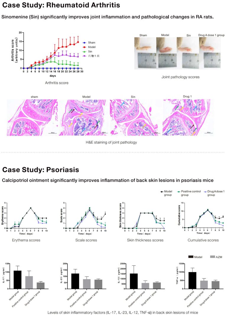 autoimmune disease models